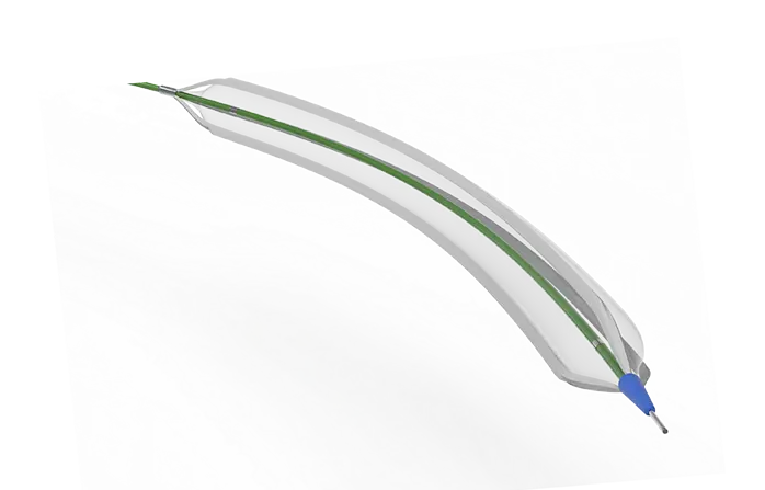 Zenflow Pufferfish™ Scoring Balloon Catheter